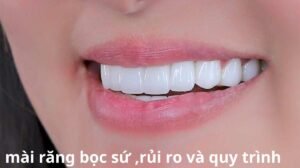mài răng bọc sứ, rủi ro và quy trình
