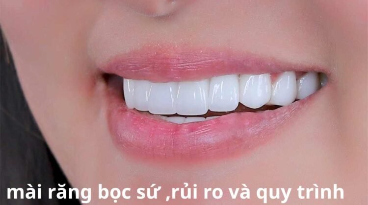 mài răng bọc sứ, rủi ro và quy trình