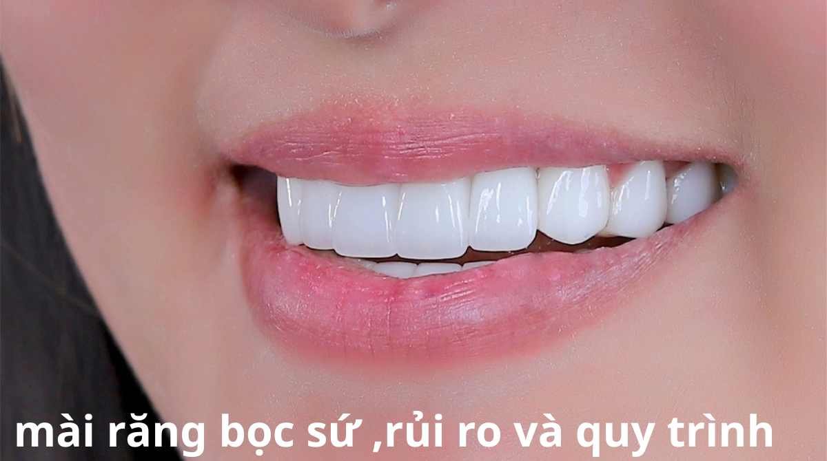mài răng bọc sứ, rủi ro và quy trình